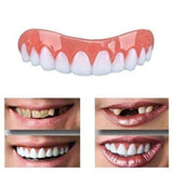 Perfect Smile Teeth White Cosmetic Veneers-Sulit Promos
