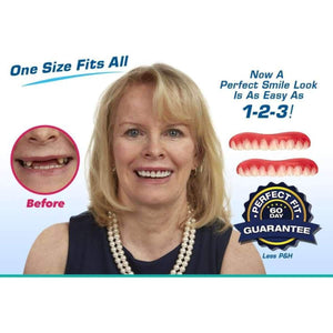 Perfect Smile Teeth White Cosmetic Veneers-Sulit Promos